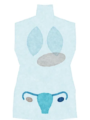 Stage I: cancer in the ovary only